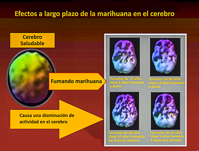 Efectos de la marihuana en el cerebro.